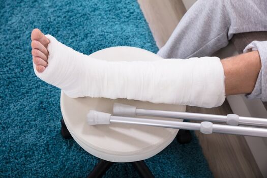 brokenleg