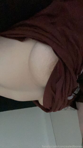 ConcealedBones