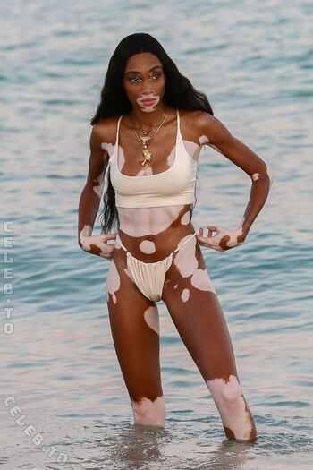 Winnie Harlow