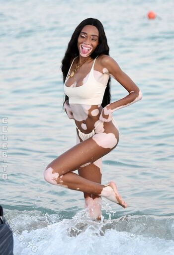 Winnie Harlow