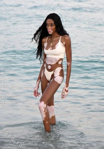 Winnie Harlow